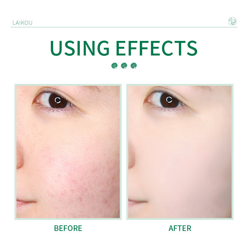 Centella Asiatica Facial Cleanser – Daily Face Wash