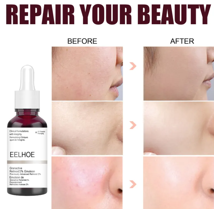 Face Serum – Dropper Bottle with Box