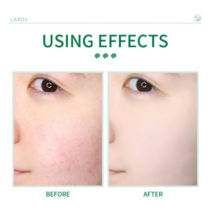 Centella Asiatica Facial Cleanser – Daily Face Wash