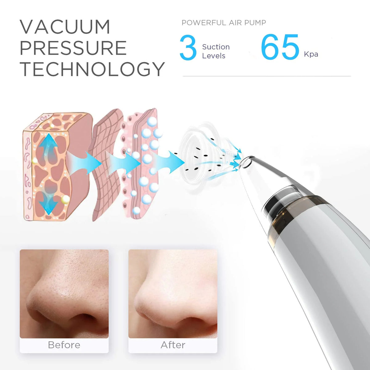 USB Electric Pore Vacuum Cleaner with 5 Probes – White