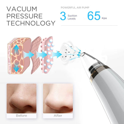 USB Electric Pore Vacuum Cleaner with 5 Probes – White
