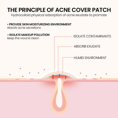 Acne Pimple Patches