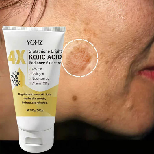 Kojic Acid Face Cream Evens Out Skin Tone, Eliminates Dark Spots