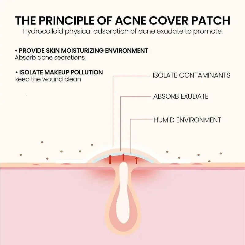 Acne Pimple Patches