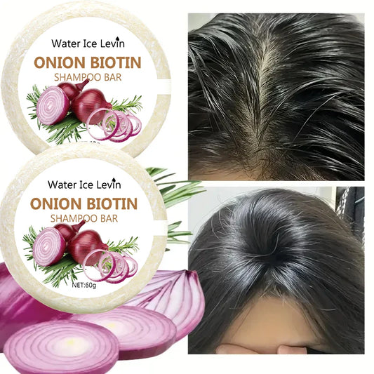 Onion Biotin Shampoo Bar - 60g, Suitable for All Hair Types