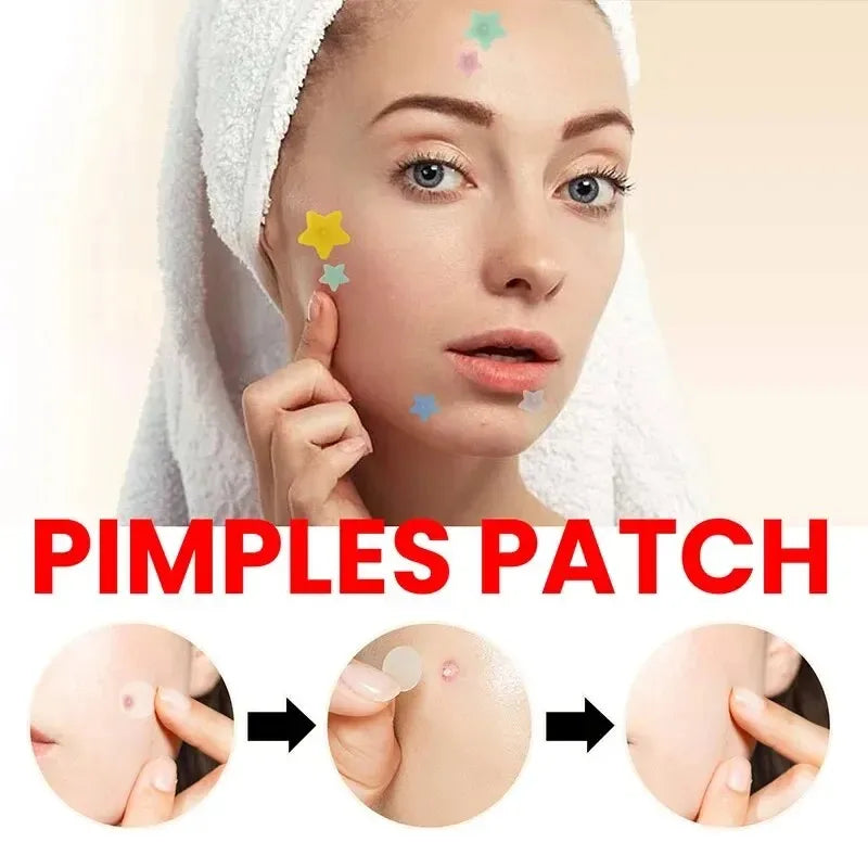 Acne Pimple Patches