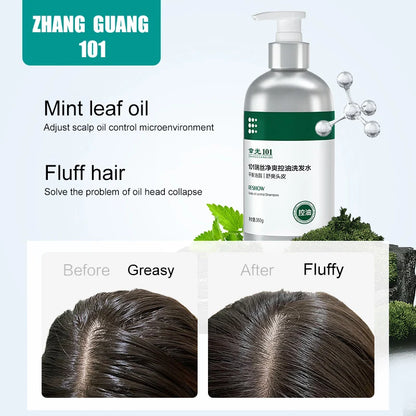 Zhang Guang 101 Soothing Oil Control Scalp Cleansing Water Oil