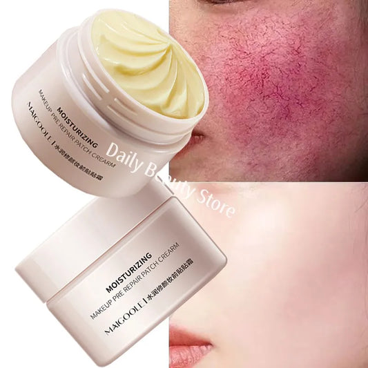 Facial Redness Repair Cream Improve Sensitive Skin Dryness