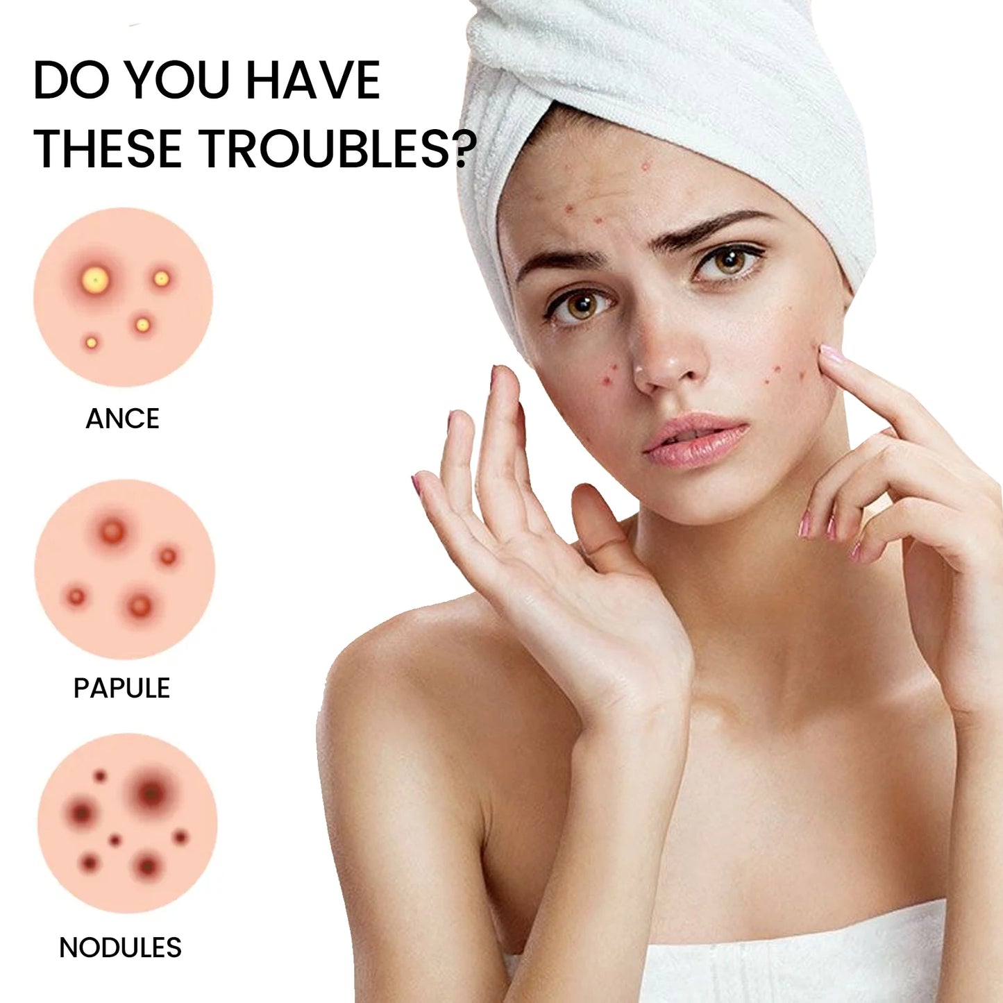 Acne Pimple Patches