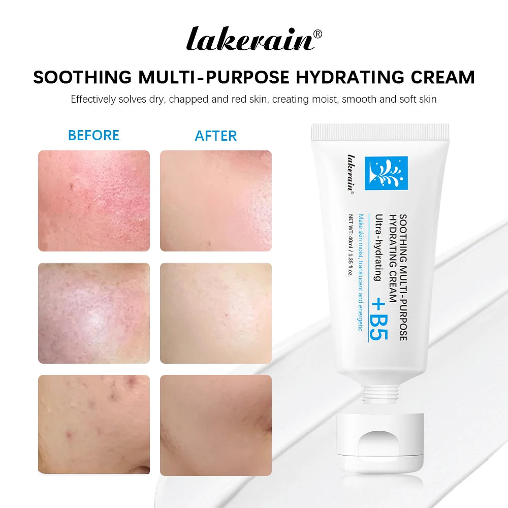 B5 Repair Cream Moisturizing Hydrating Effectively Solves Dry